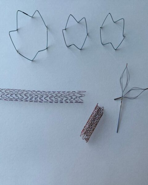 nickel titanium laser cutting (12)(1) nickel titanium laser cutting (12)(1)